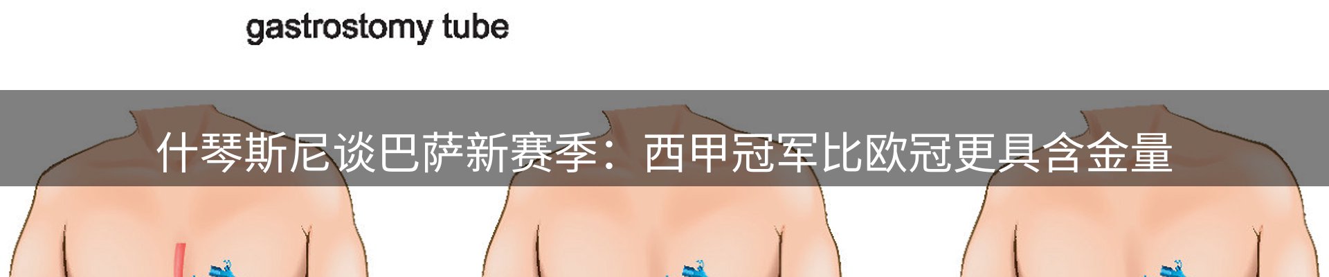 行业简报